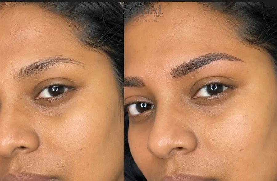 Microblading brow result before and after — Skulpted by Kan